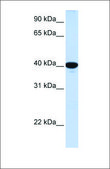 Anti-G6PC affinity isolated antibody