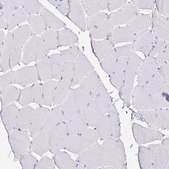 Anti-TTR antibody produced in rabbit Prestige Antibodies® Powered by Atlas Antibodies, affinity isolated antibody, buffered aqueous glycerol solution