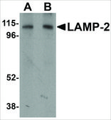 Anti-LAMP-2 antibody produced in rabbit affinity isolated antibody, buffered aqueous solution