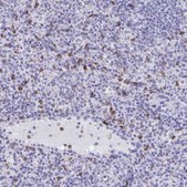 Anti-CD7 antibody produced in rabbit Prestige Antibodies® Powered by Atlas Antibodies, affinity isolated antibody, buffered aqueous glycerol solution
