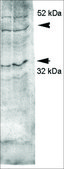 Anti-AQP4 antibody produced in rabbit 1 mg/mL, affinity isolated antibody
