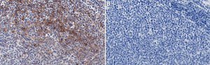 Anti-TGFBR2 Antibody, clone 1N11 ZooMAb® Rabbit Monoclonal recombinant, expressed in HEK 293 cells
