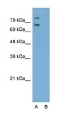 Anti-RORA (AB3) antibody produced in rabbit IgG fraction of antiserum