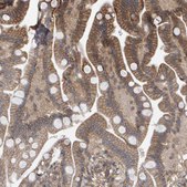 Anti-SCRIB antibody produced in rabbit Prestige Antibodies® Powered by Atlas Antibodies, affinity isolated antibody, buffered aqueous glycerol solution