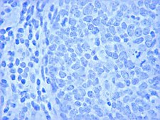 Anti-Ki-67 Antibody Chemicon®, from rabbit