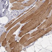 Anti-MB antibody produced in rabbit Prestige Antibodies® Powered by Atlas Antibodies, affinity isolated antibody, buffered aqueous glycerol solution