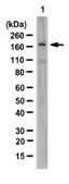 Anti-JHDM1B Antibody from rabbit, purified by affinity chromatography