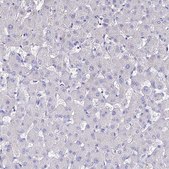 Anti-NME5 antibody produced in rabbit affinity isolated antibody, buffered aqueous glycerol solution