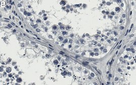 Anti-DNMT3B Antibody, clone 2N12 ZooMAb® Rabbit Monoclonal recombinant, expressed in HEK 293 cells