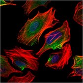 Anti-ACLY, clone 5F8D11 Antibody clone 5F8D11, from mouse