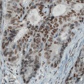 Monoclonal Anti-KDM5B antibody produced in mouse Prestige Antibodies® Powered by Atlas Antibodies, clone CL1129, purified immunoglobulin, buffered aqueous glycerol solution