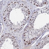 Anti-BRD2 antibody produced in rabbit Prestige Antibodies® Powered by Atlas Antibodies, affinity isolated antibody, buffered aqueous glycerol solution