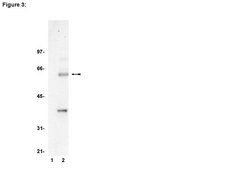 ChIPAb+ TCF-4 - ChIP Validated Antibody and Primer Set from mouse