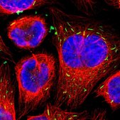 Anti-STK3 antibody produced in rabbit Prestige Antibodies® Powered by Atlas Antibodies, affinity isolated antibody, buffered aqueous glycerol solution