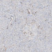 Anti-HLA-E antibody produced in rabbit Prestige Antibodies® Powered by Atlas Antibodies, affinity isolated antibody, buffered aqueous glycerol solution