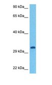 Anti-IL1B antibody produced in rabbit affinity isolated antibody