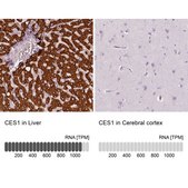 Anti-CES1 antibody produced in rabbit Prestige Antibodies® Powered by Atlas Antibodies, affinity isolated antibody, buffered aqueous glycerol solution
