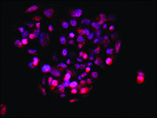 Anti-TDP-43 (C-terminal) antibody produced in rabbit ~1.0 mg/mL, affinity isolated antibody, buffered aqueous solution