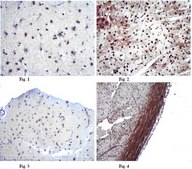Anti-Mitofusin-2 (Mfn2) Antibody from rabbit, purified by affinity chromatography
