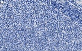 Anti-TGFBR2 Antibody, clone 1N11 ZooMAb® Rabbit Monoclonal recombinant, expressed in HEK 293 cells