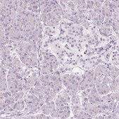Anti-VCAM1 antibody produced in rabbit Prestige Antibodies® Powered by Atlas Antibodies, affinity isolated antibody, buffered aqueous glycerol solution