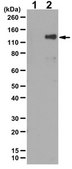 Anti-phospho TIE2/TEK Antibody (Tyr992) 0.25 mg/mL, from rabbit
