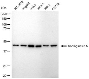 KD-Validated Anti Sorting Nexin 5 Antibody, clone 24GB2310, Rabbit Monoclonal clone 24GB2310, recombinant rabbit monoclonal, expressed in HEK293 cells