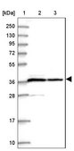 Anti-PPP1CA antibody produced in rabbit Prestige Antibodies® Powered by Atlas Antibodies, affinity isolated antibody, buffered aqueous glycerol solution
