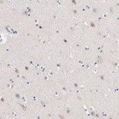 Anti-TNFRSF13C antibody produced in rabbit Prestige Antibodies® Powered by Atlas Antibodies, affinity isolated antibody, buffered aqueous glycerol solution