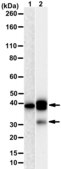 Anti-HDAC11 Antibody, clone 1E11 ZooMAb® Rabbit Monoclonal recombinant, expressed in HEK 293 cells