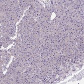 Anti-KCNB1 antibody produced in rabbit Prestige Antibodies® Powered by Atlas Antibodies, affinity isolated antibody, buffered aqueous glycerol solution