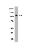 Anti-P-Cadherin Antibody, clone 6A9 ascites fluid, clone 6A9, Upstate®
