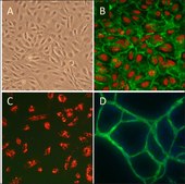 Human Umbilical Vein Endothelial Cells: HUVEC: Pre-Screened for Angiogenesis &amp; VEGF signaling, neonatal