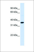 Anti-FOS antibody produced in rabbit affinity isolated antibody