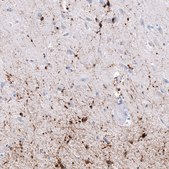 Monoclonal Anti-CRYAB antibody produced in mouse Prestige Antibodies® Powered by Atlas Antibodies, clone CL10765, purified antibody (Protein A)