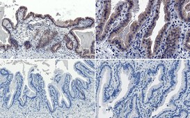 抗AMPKα 1抗体 Upstate®, from rabbit