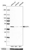 Anti-ACAT1 antibody produced in rabbit Prestige Antibodies® Powered by Atlas Antibodies, affinity isolated antibody, buffered aqueous glycerol solution