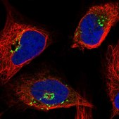 抗-OSBP 兔抗 Prestige Antibodies® Powered by Atlas Antibodies, affinity isolated antibody, buffered aqueous glycerol solution