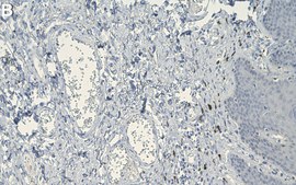 Anti-Elastin Antibody, clone 10B8 ZooMAb® Mouse Monoclonal recombinant, expressed in HEK 293 cells