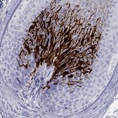 Anti-TYR antibody produced in rabbit Prestige Antibodies® Powered by Atlas Antibodies, affinity isolated antibody, buffered aqueous glycerol solution