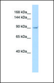 Anti-TRPV4 antibody produced in rabbit affinity isolated antibody