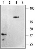 抗-嘌呤能受体P2Y12 兔抗 affinity isolated antibody, lyophilized powder