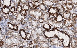 Anti-VDAC1 Antibody, clone 3M22, ZooMAb® Rabbit Monoclonal recombinant, expressed in HEK 293 cells