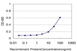 Monoclonal Anti-IL18BP antibody produced in mouse clone 2A9, purified immunoglobulin, buffered aqueous solution