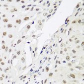 Anti-CBX3 antibody produced in rabbit
