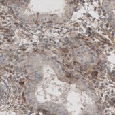 Monoclonal Anti-LAMB1 antibody produced in mouse Prestige Antibodies® Powered by Atlas Antibodies, clone CL2970, purified immunoglobulin, buffered aqueous glycerol solution