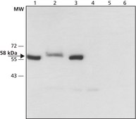 Anti-Monoamine Oxidase B (C-terminal) 兔抗 affinity isolated antibody, ~1.5 mg/mL, buffered aqueous solution