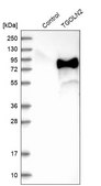 Anti-TGOLN2 antibody produced in rabbit Prestige Antibodies® Powered by Atlas Antibodies, affinity isolated antibody, buffered aqueous glycerol solution
