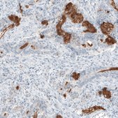 Monoclonal Anti-MUC2 antibody produced in mouse Prestige Antibodies® Powered by Atlas Antibodies, clone CL9148, purified immunoglobulin, buffered aqueous glycerol solution