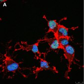 Anti-Olig2 Antibody, clone 1K2 ZooMAb® Rabbit Monoclonal recombinant, expressed in HEK 293 cells